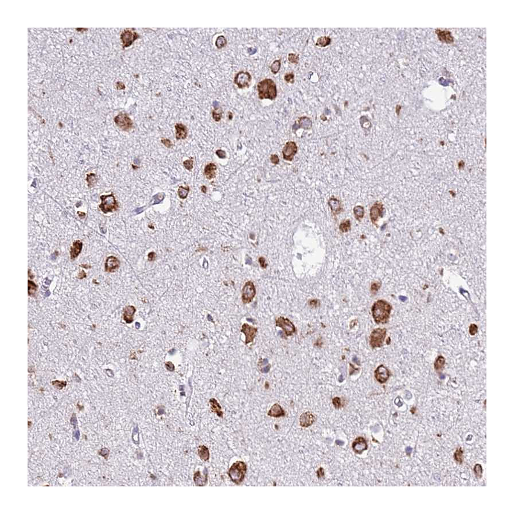 Atlas Antibodies Anti-VARS Antibody