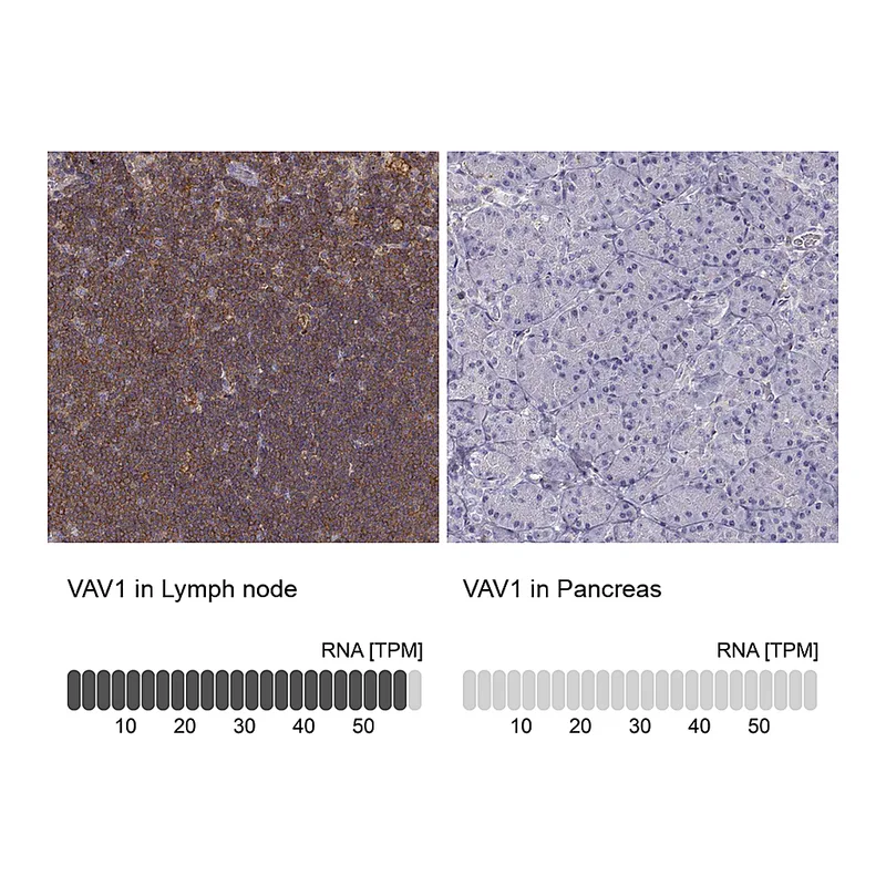 Atlas Antibodies Anti-VAV1 Antibody