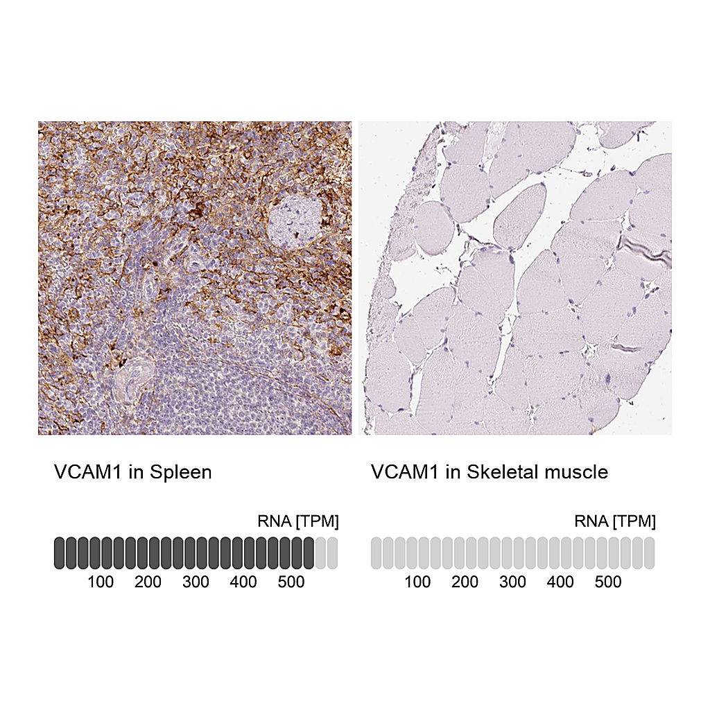 Atlas Antibodies Anti-VCAM1 Antibody