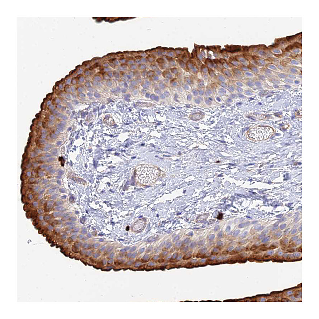 Atlas Antibodies Anti-VAT1 Antibody