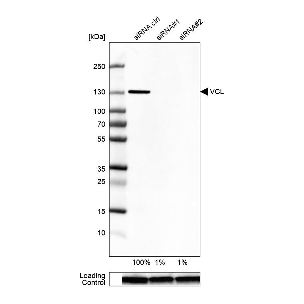 Atlas Antibodies Anti-VCL Antibody