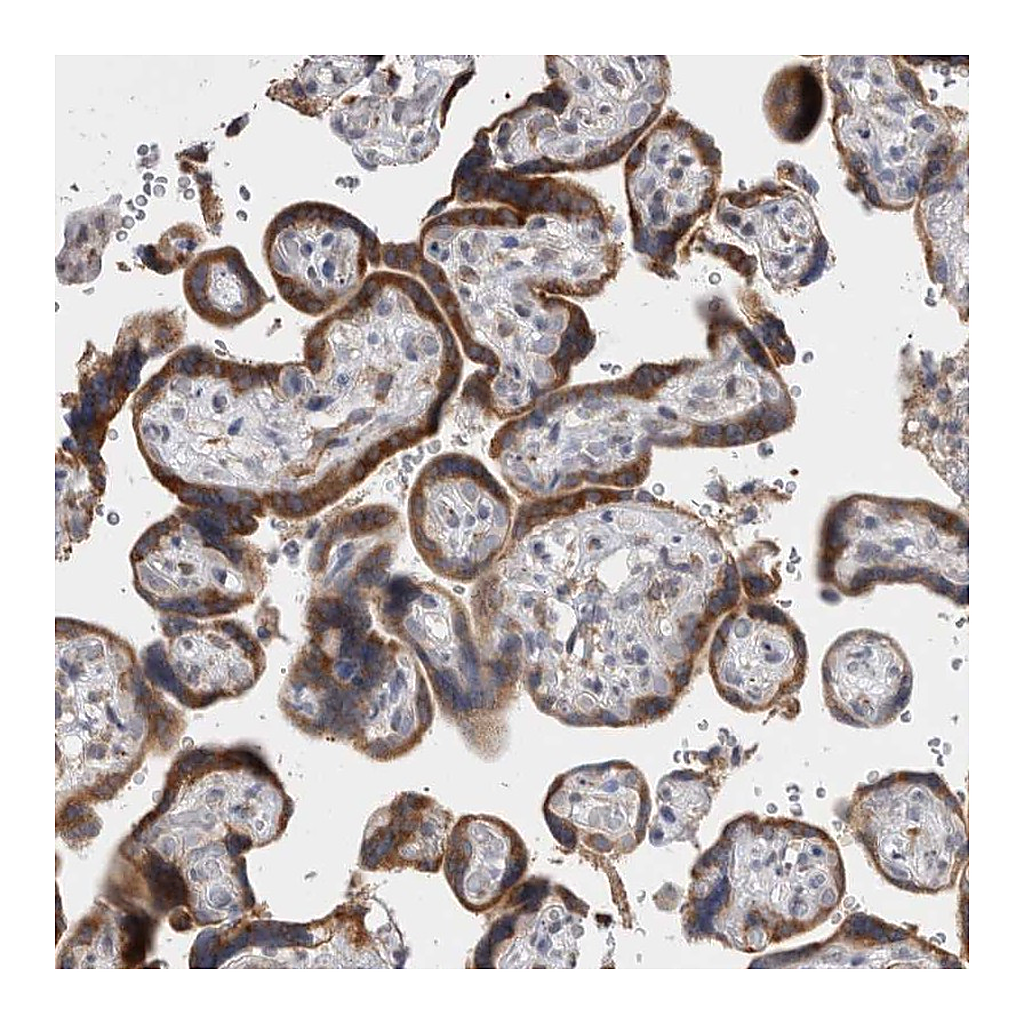 Atlas Antibodies Anti-VCPIP1 Antibody
