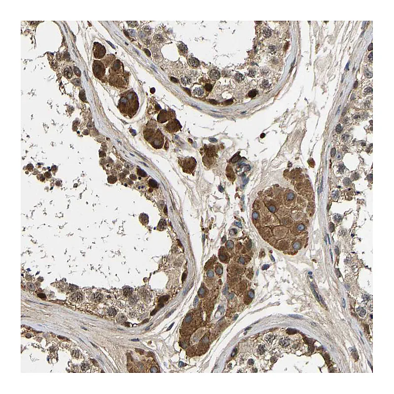 Atlas Antibodies Anti-VCPKMT Antibody