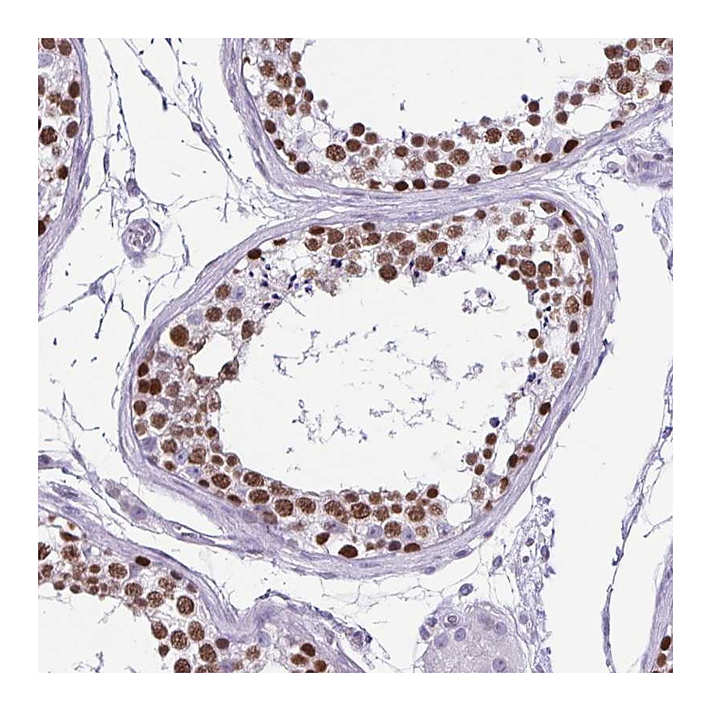 Atlas Antibodies Anti-VCX Antibody