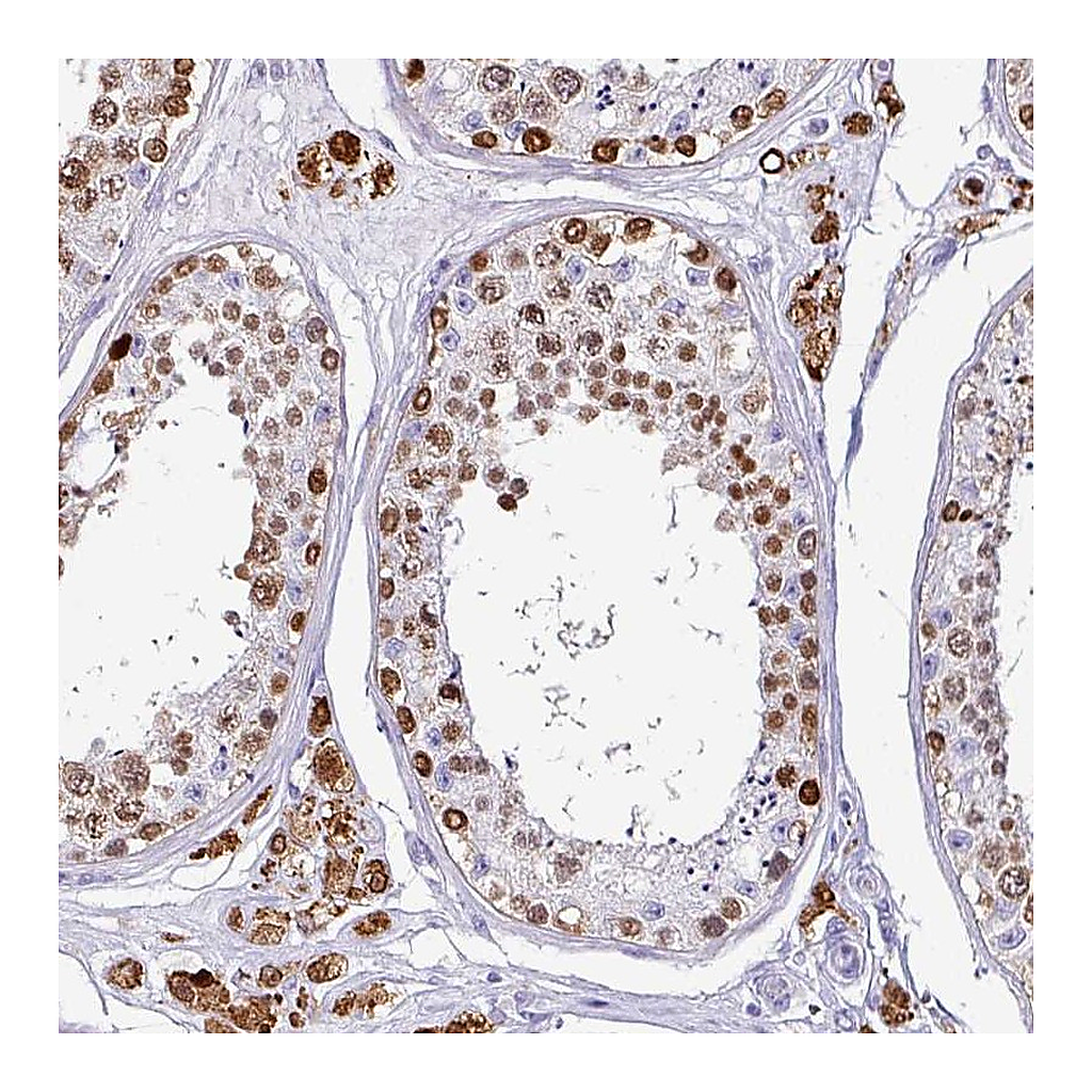 Atlas Antibodies Anti-VCY Antibody