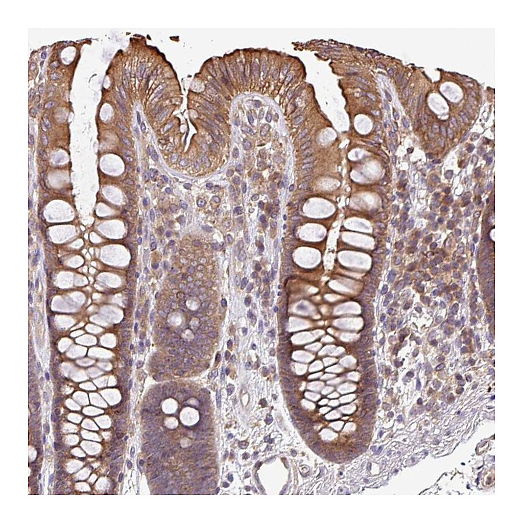 Atlas Antibodies Anti-VENTX Antibody
