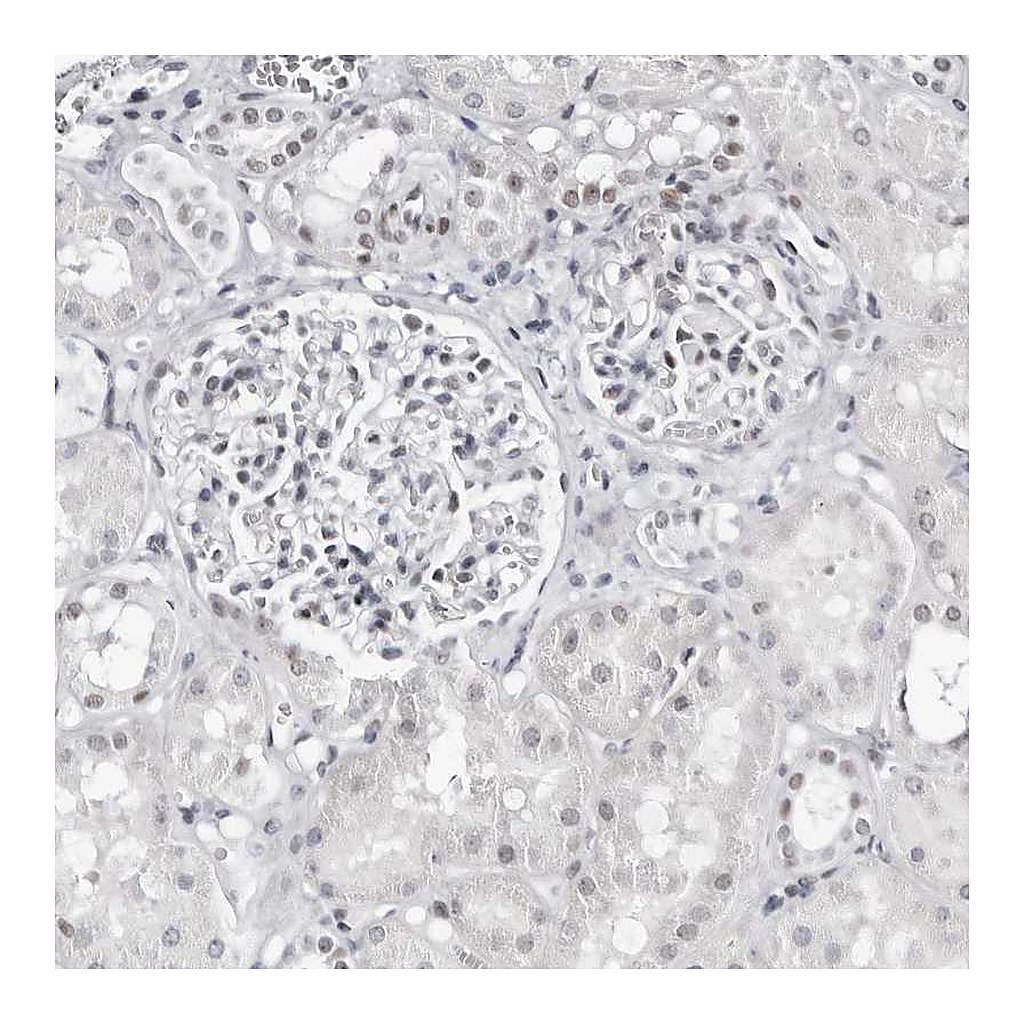 Atlas Antibodies Anti-VEZF1 Antibody