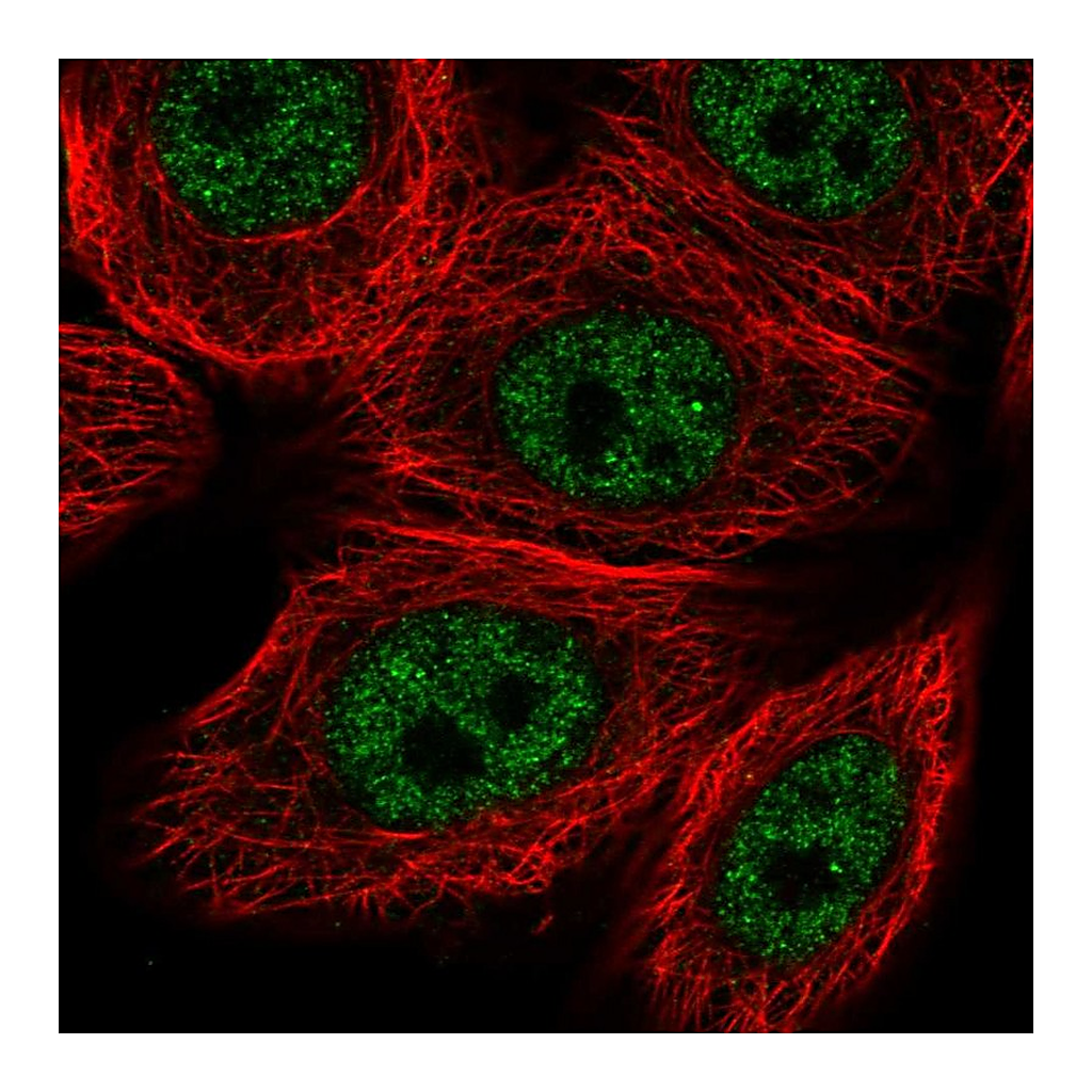 Atlas Antibodies Anti-VDR Antibody
