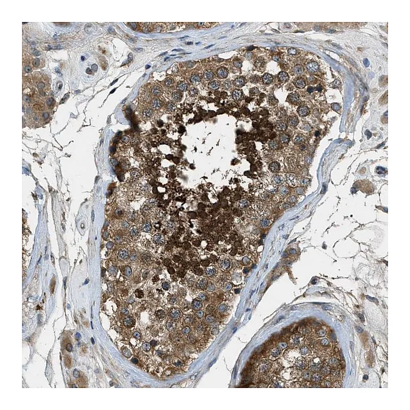 Atlas Antibodies Anti-VEZT Antibody