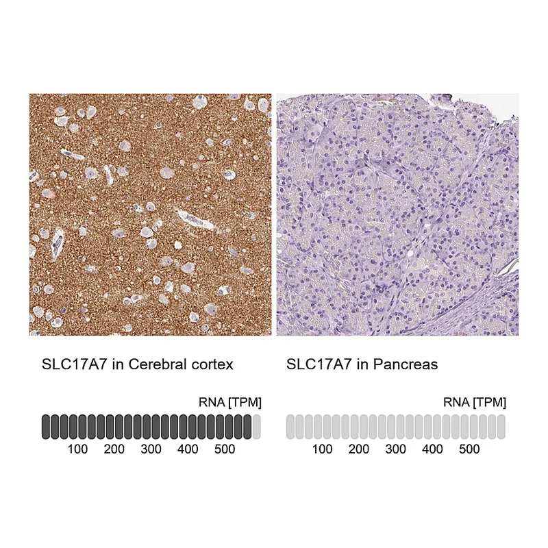 Atlas Antibodies Anti-VGLUT1 Antibody