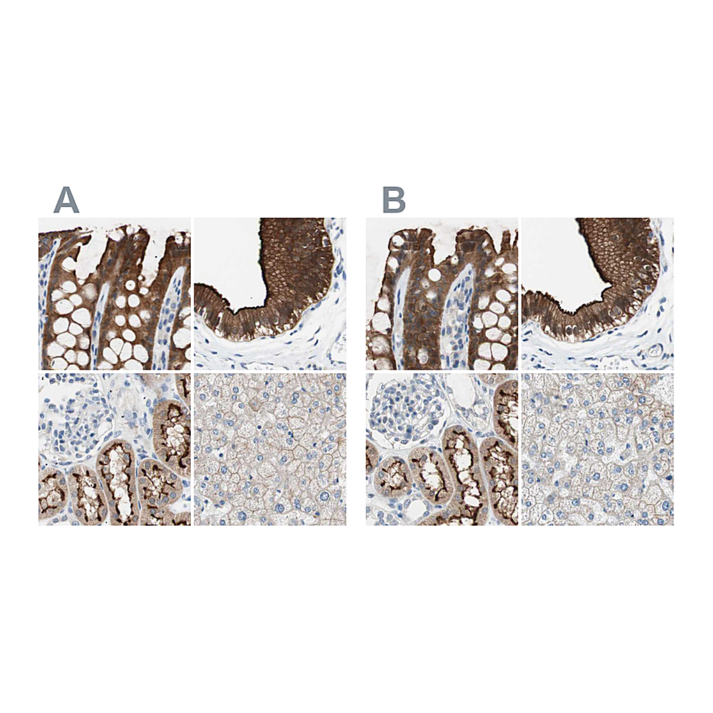 Atlas Antibodies Anti-VIL1 Antibody