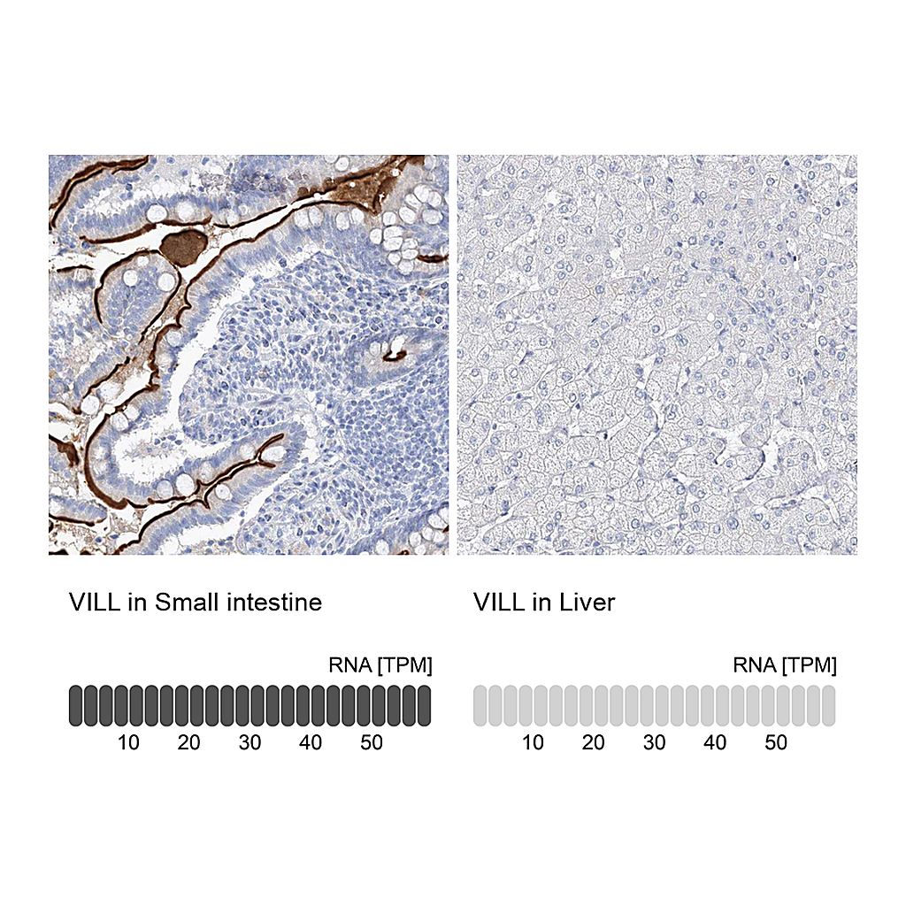 Atlas Antibodies Anti-VILL Antibody