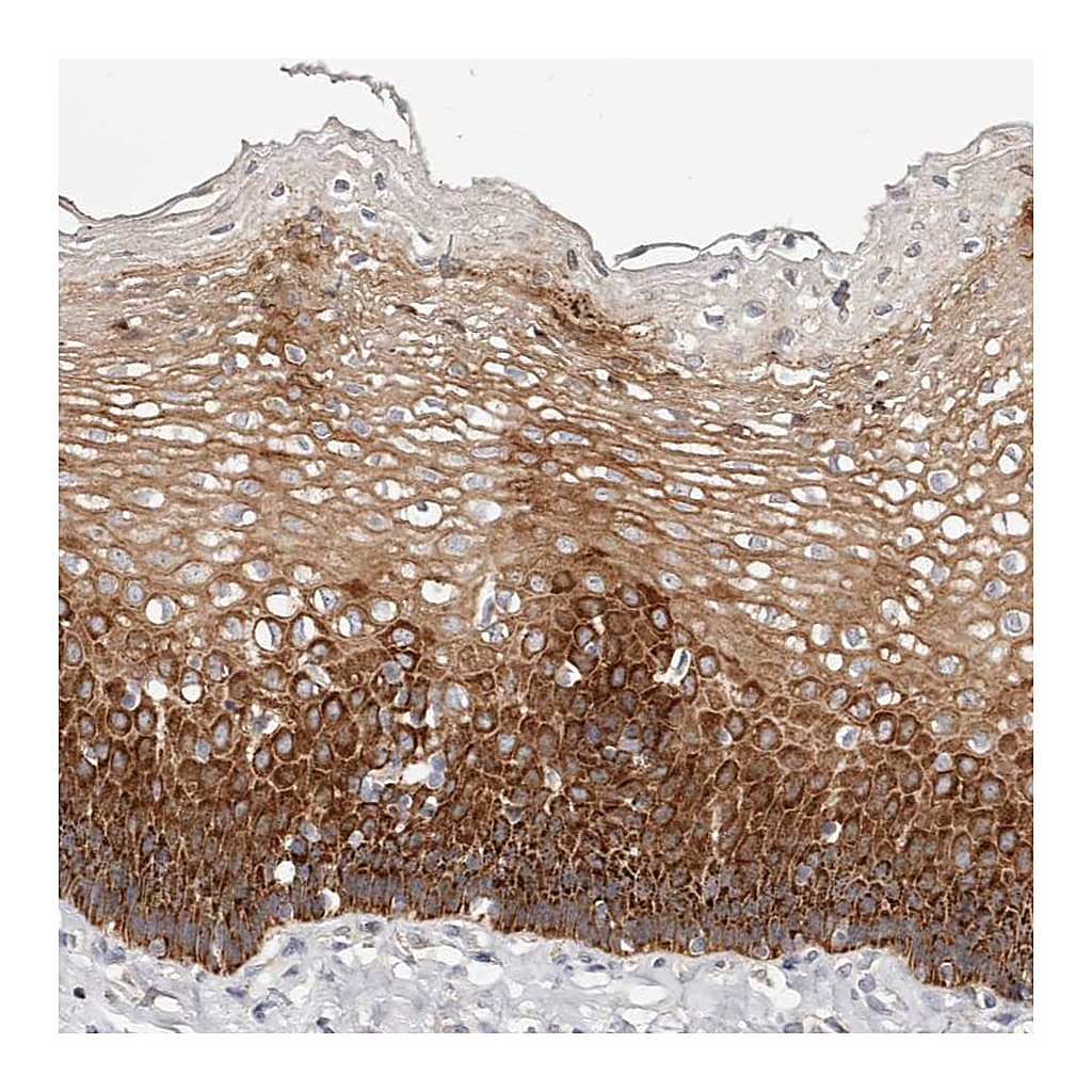 Atlas Antibodies Anti-VIPAS39 Antibody