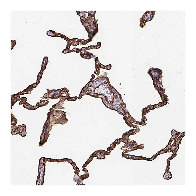 Atlas Antibodies Anti-VIPR2 Antibody