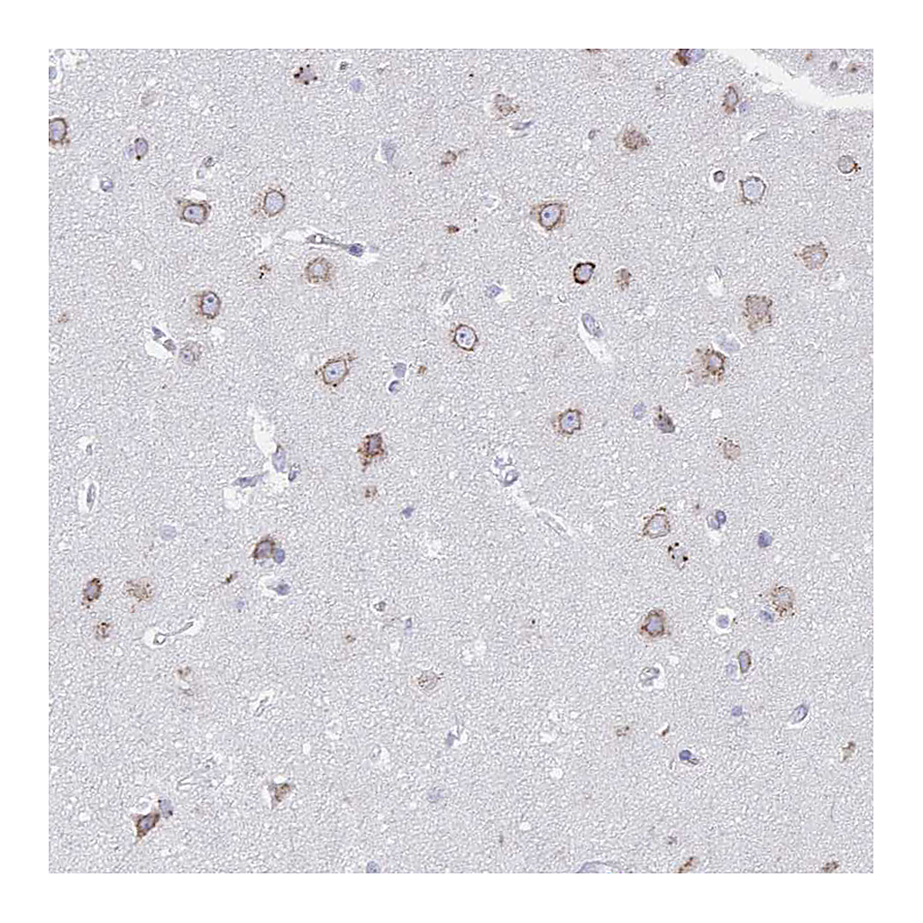 Atlas Antibodies Anti-VKORC1L1 Antibody