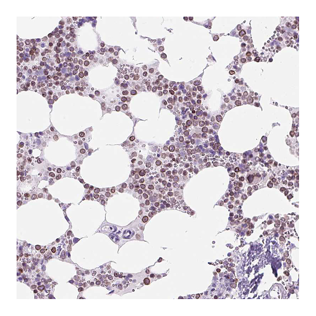 Atlas Antibodies Anti-VPREB1 Antibody