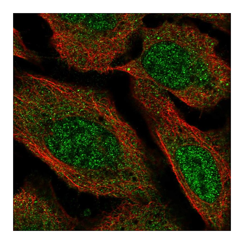 Atlas Antibodies Anti-VPS13D Antibody