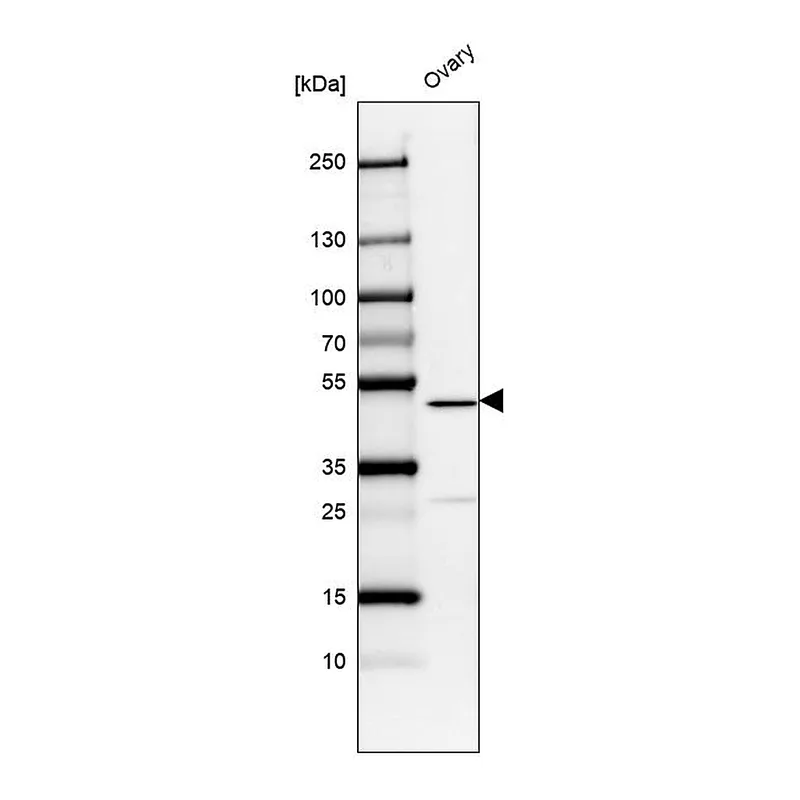 Atlas Antibodies Anti-VPS13B Antibody