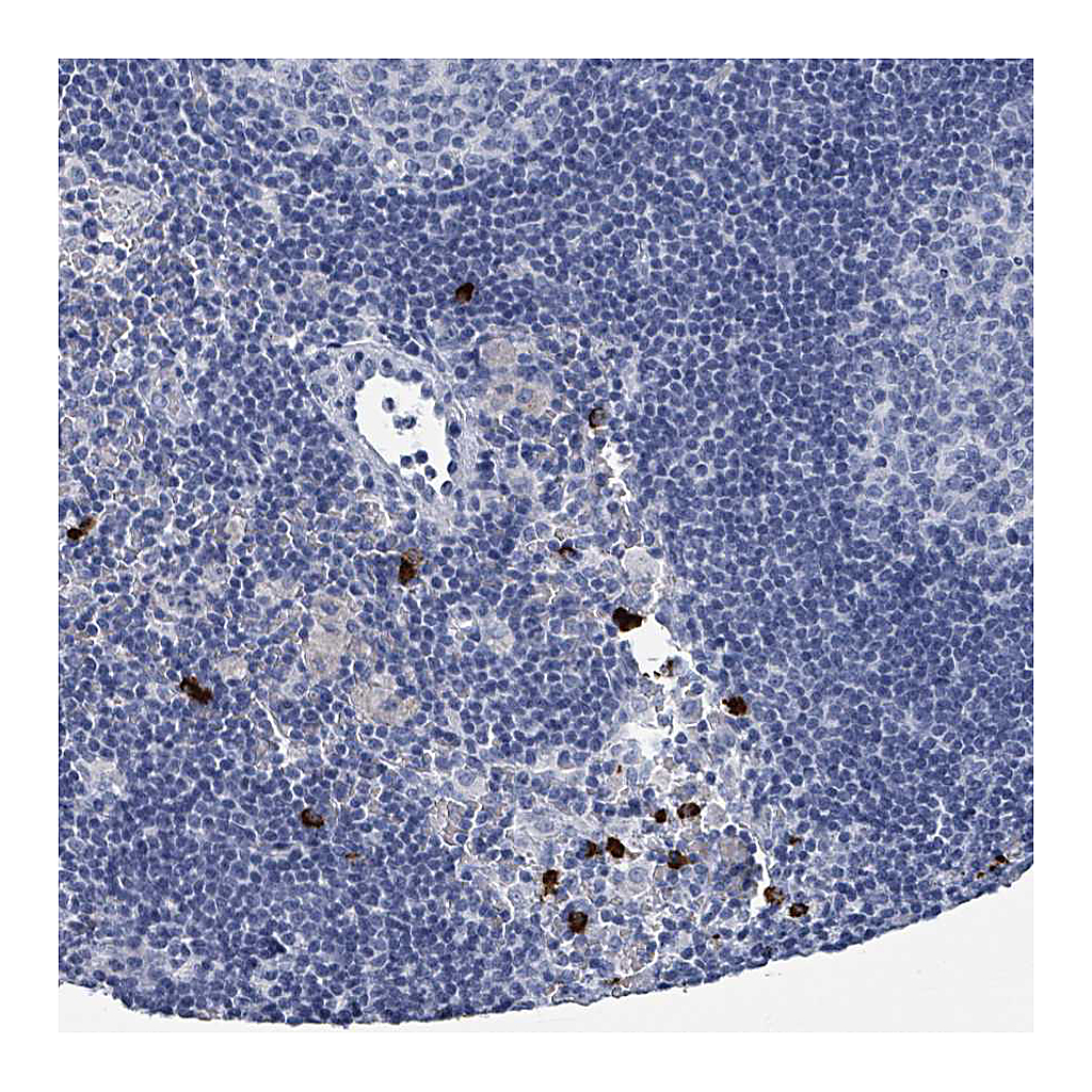 Atlas Antibodies Anti-VPS13D Antibody