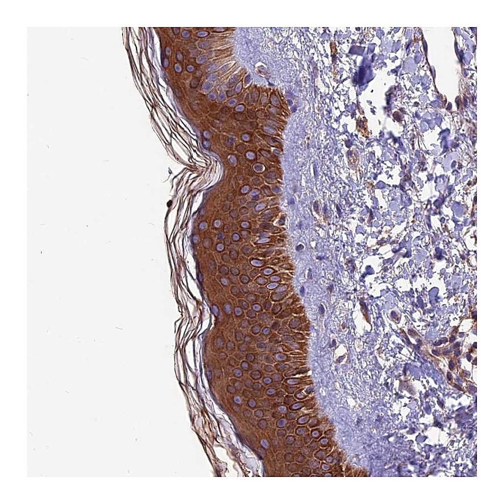 Atlas Antibodies Anti-VPS16 Antibody