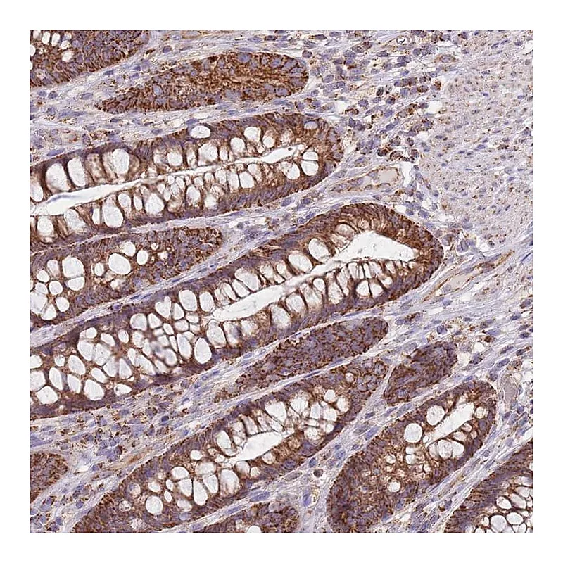 Atlas Antibodies Anti-VPS16 Antibody