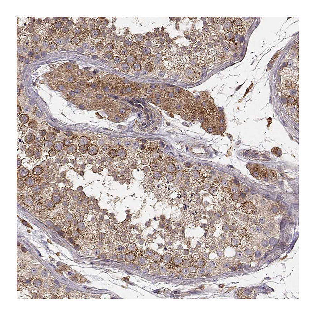 Atlas Antibodies Anti-VPS26A Antibody
