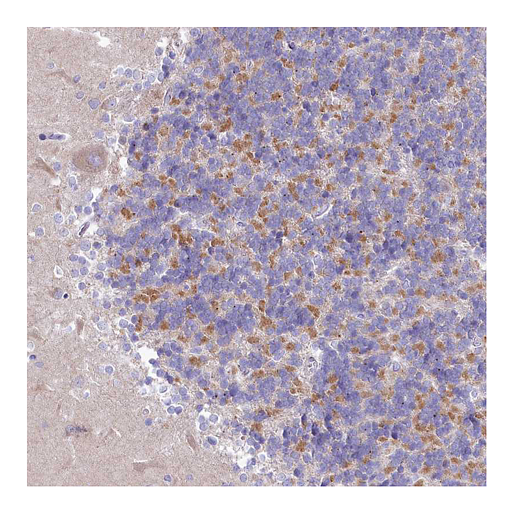 Atlas Antibodies Anti-VPS26B Antibody