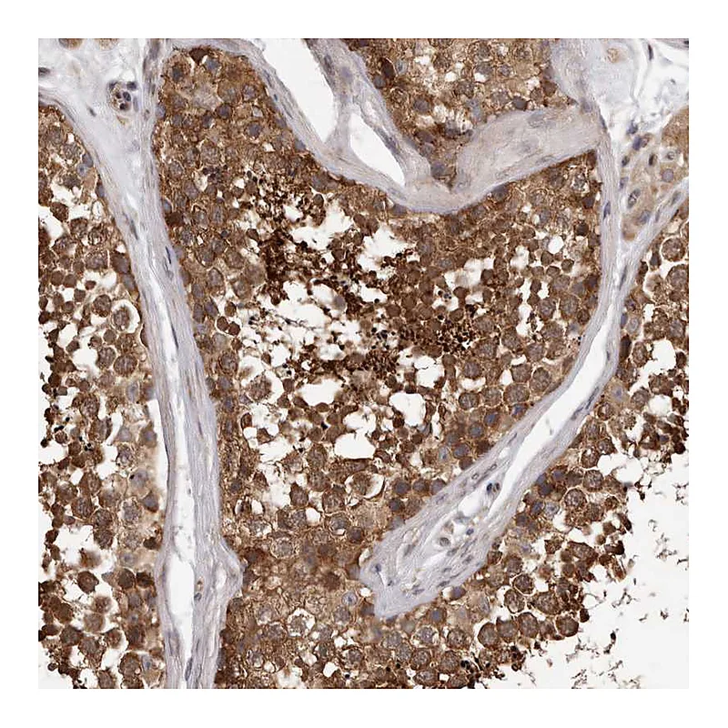 Atlas Antibodies Anti-VPS37A Antibody