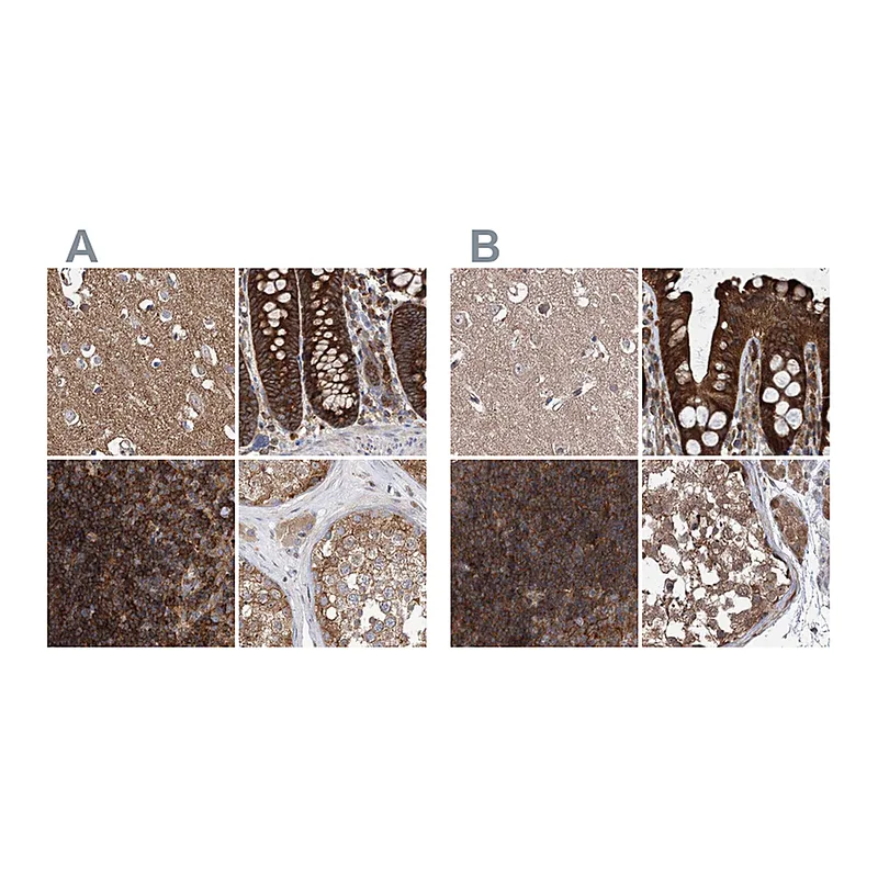 Atlas Antibodies Anti-VPS37B Antibody