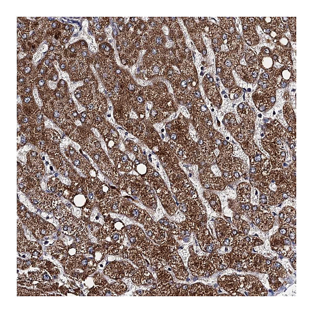 Atlas Antibodies Anti-VPS37D Antibody