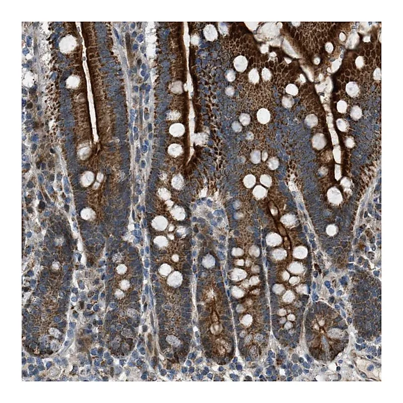 Atlas Antibodies Anti-VPS41 Antibody