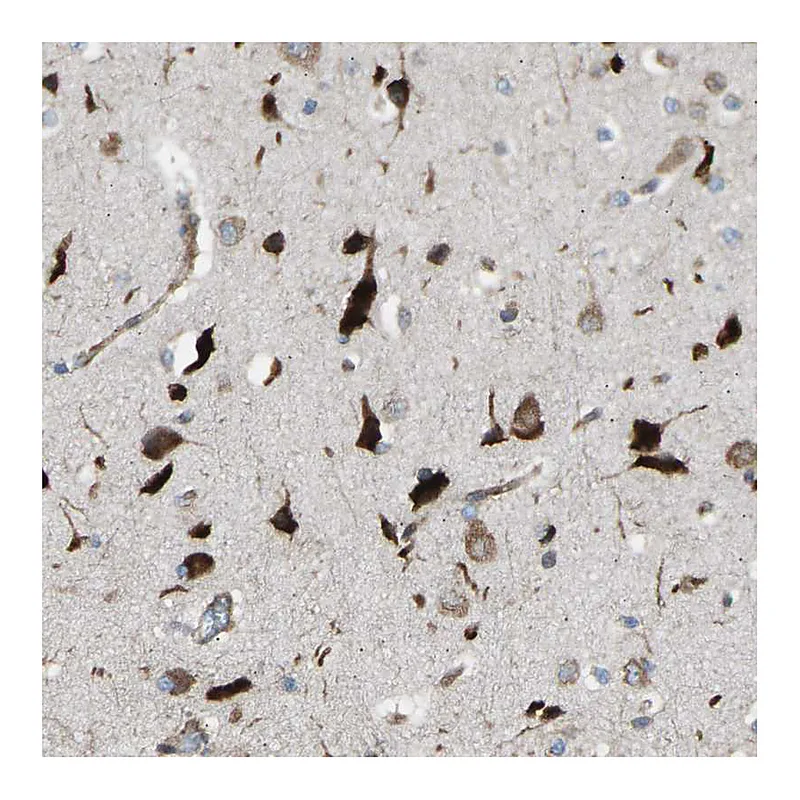 Atlas Antibodies Anti-VPS41 Antibody