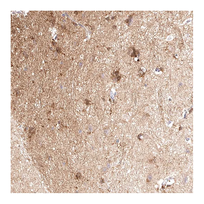 Atlas Antibodies Anti-VPS45 Antibody
