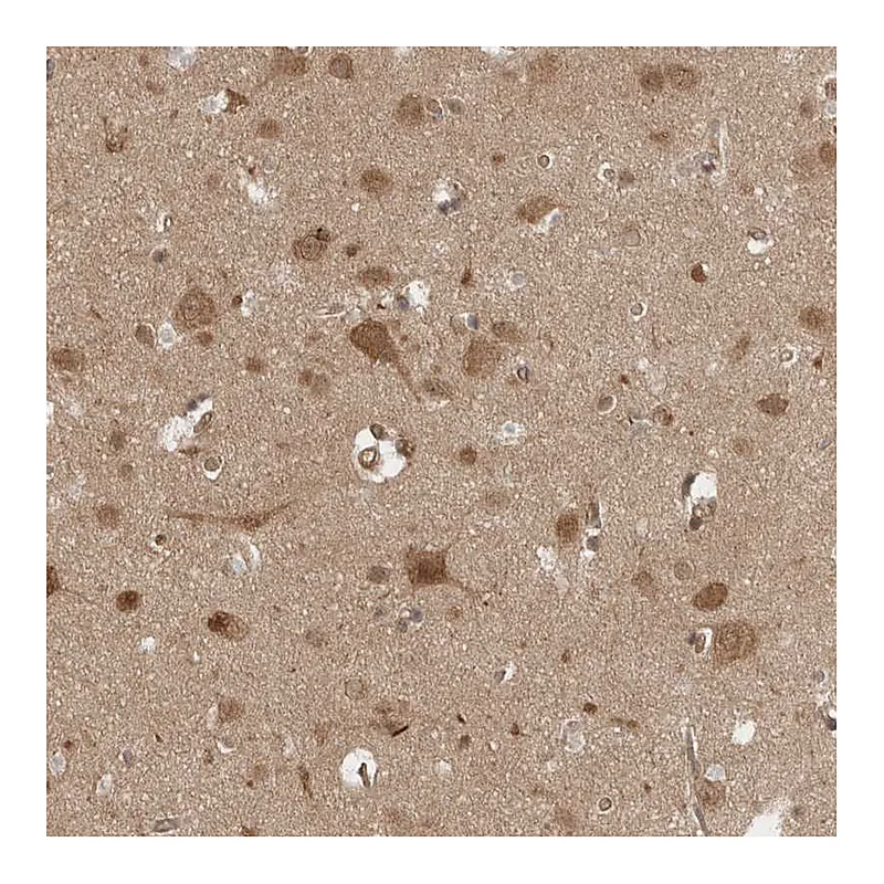 Atlas Antibodies Anti-VPS50 Antibody