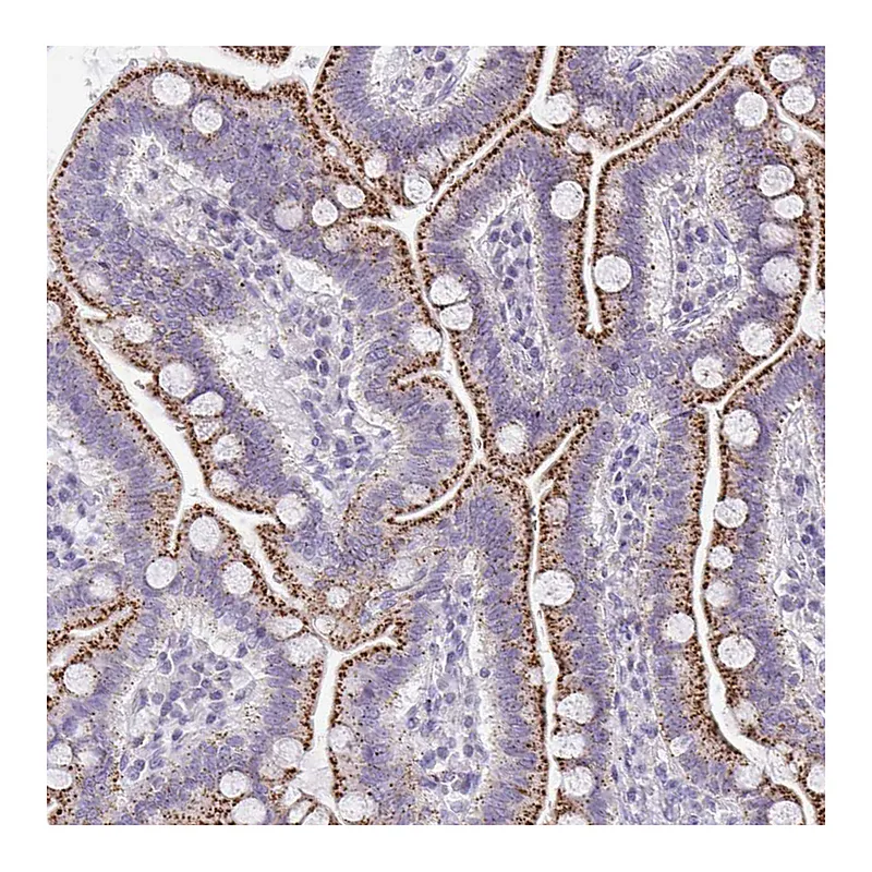 Atlas Antibodies Anti-VPS4B Antibody