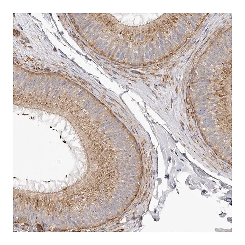 Atlas Antibodies Anti-VPS45 Antibody