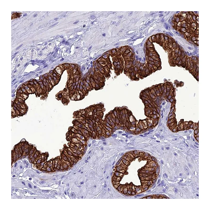 Atlas Antibodies Anti-VPS52 Antibody