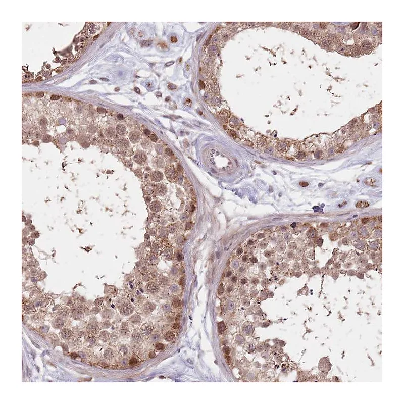Atlas Antibodies Anti-VPS52 Antibody