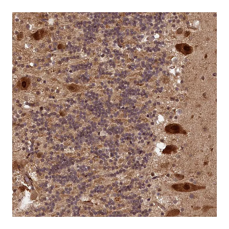 Atlas Antibodies Anti-VPS51 Antibody