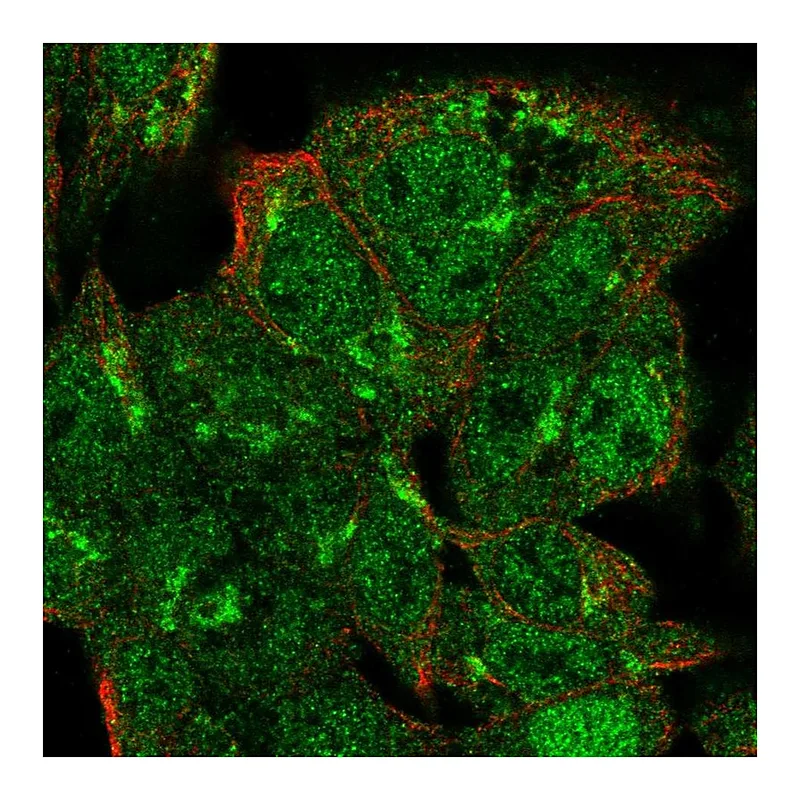 Atlas Antibodies Anti-VPS54 Antibody