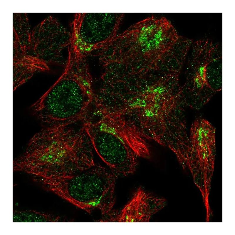 Atlas Antibodies Anti-VPS54 Antibody
