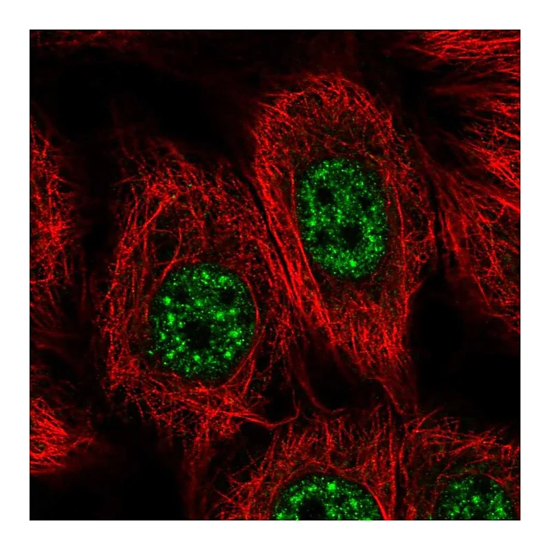 Atlas Antibodies Anti-VPS72 Antibody