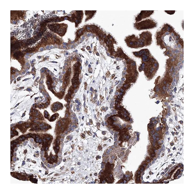 Atlas Antibodies Anti-VPS8 Antibody