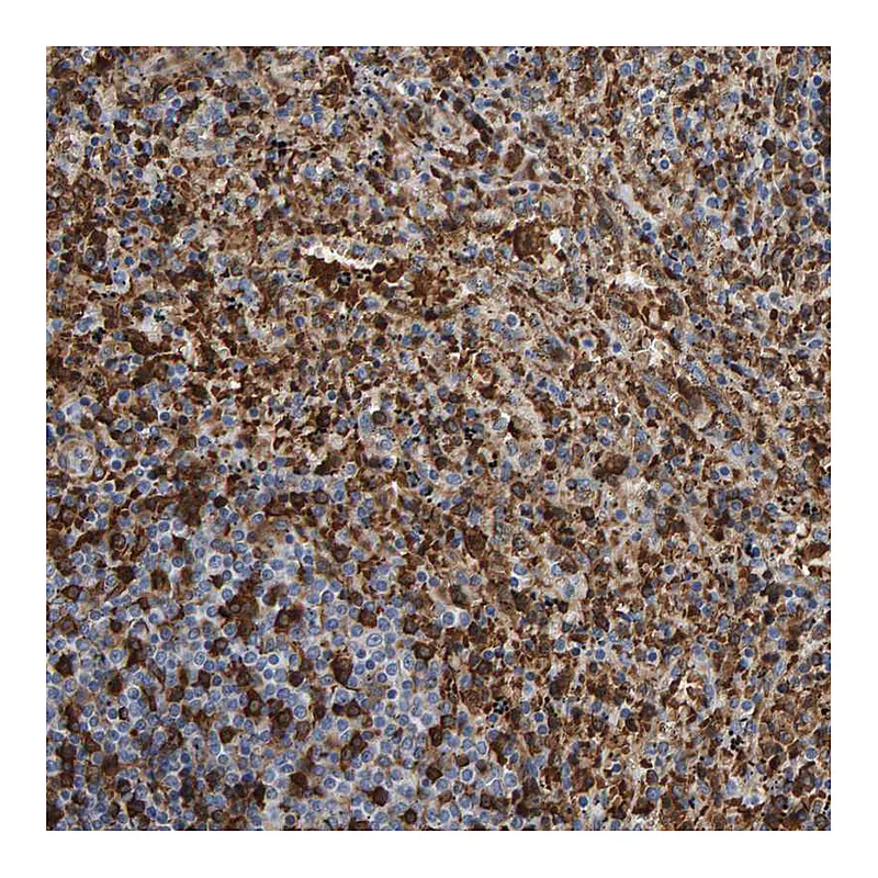 Atlas Antibodies Anti-VPS9D1 Antibody