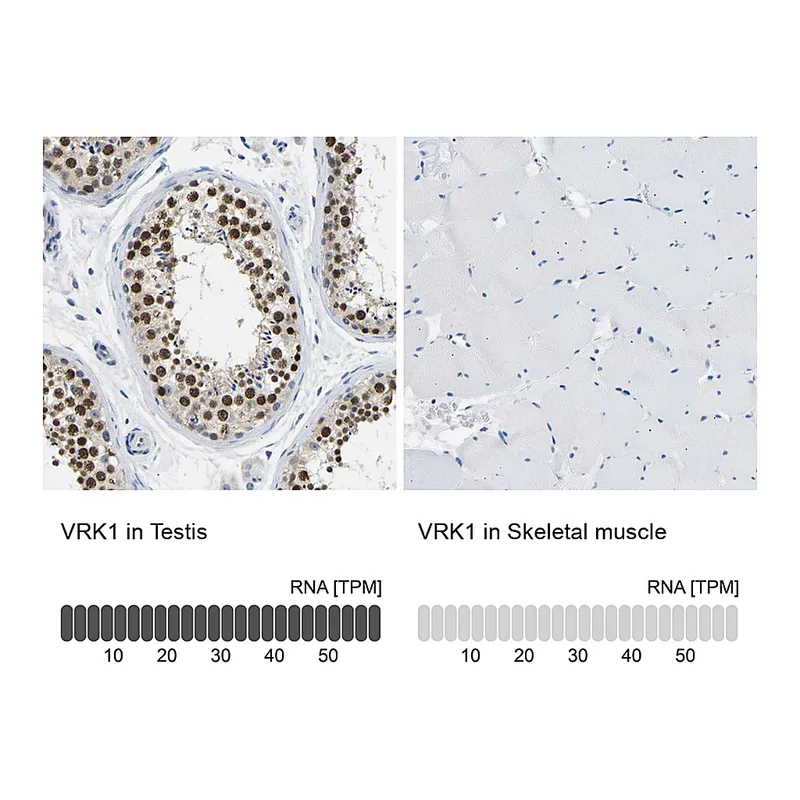 Atlas Antibodies Anti-VRK1 Antibody