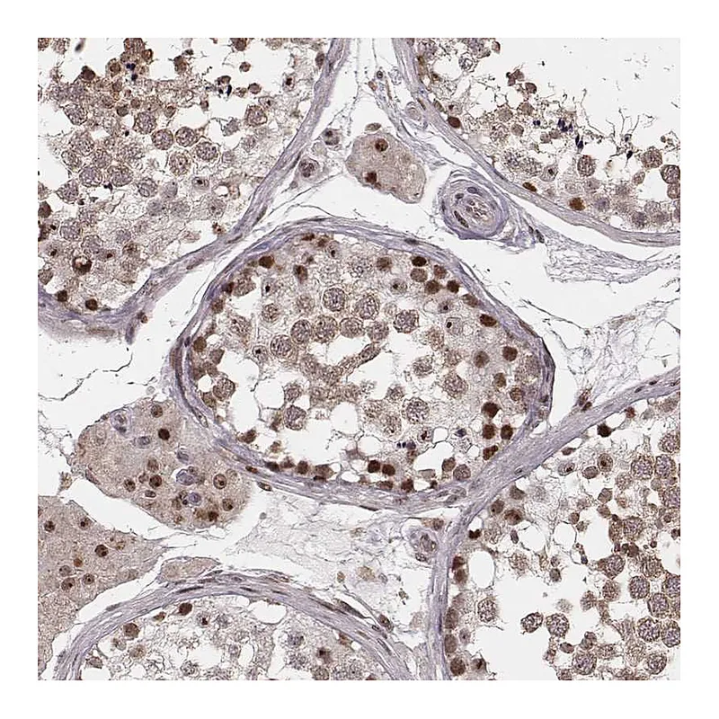 Atlas Antibodies Anti-VRK3 Antibody