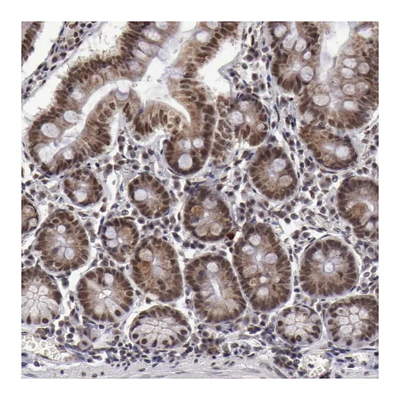 Atlas Antibodies Anti-VRTN Antibody