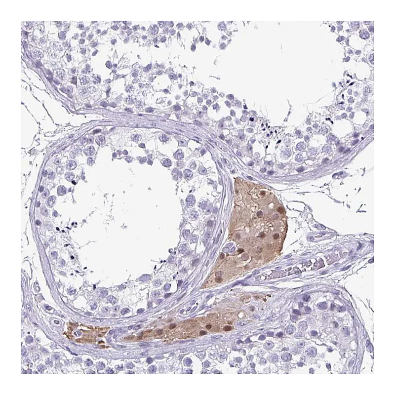 Atlas Antibodies Anti-VSIG10L Antibody