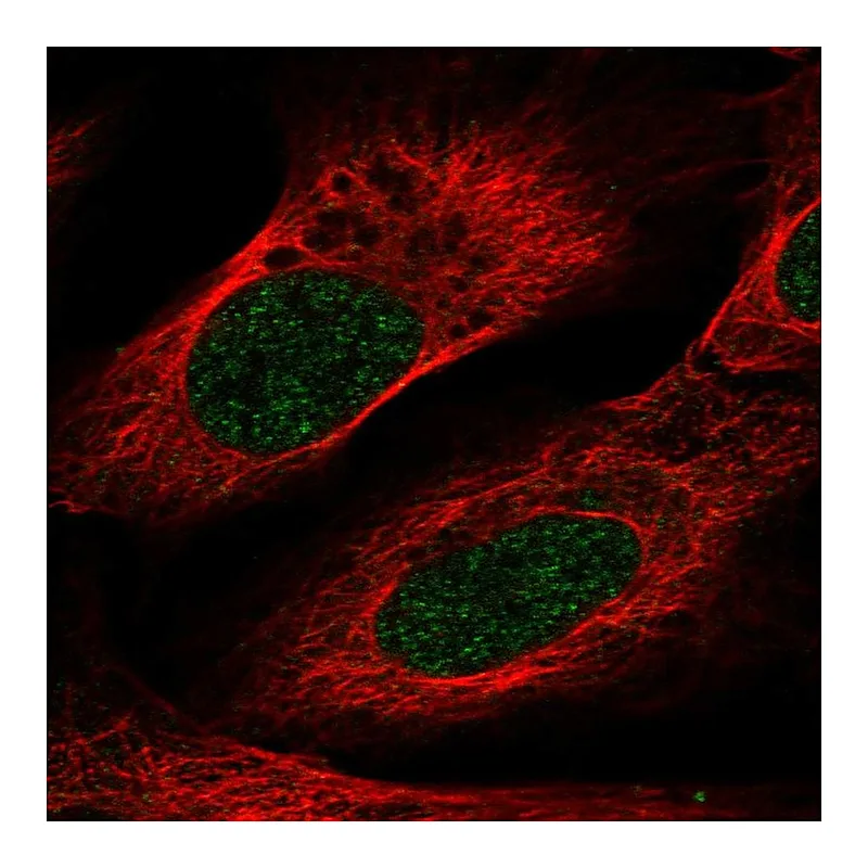 Atlas Antibodies Anti-VSIG10L Antibody