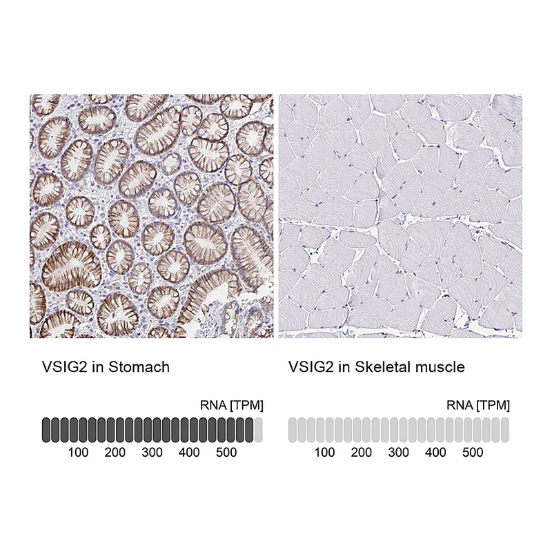 Atlas Antibodies Anti-VSIG2 Antibody